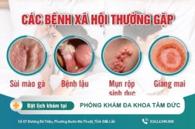 Tìm Hiểu Bệnh Xã Hội Ở Nam Giới - Cách Chữa Trị Bệnh Xã Hội Nhanh Chóng