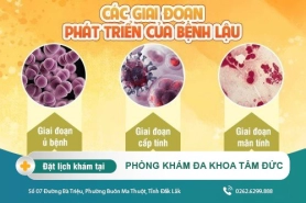 Bệnh lậu có mấy giai đoạn? Biểu hiện của từng giai đoạn