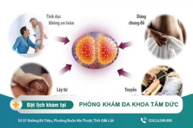 Cách chữa trị bệnh lậu tại Đắk Lắk – Tại sao bị bệnh lậu?