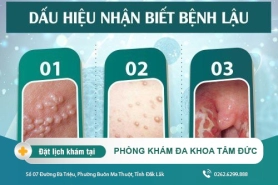 Một số dấu hiệu biểu hiện của bệnh lậu thường thấy
