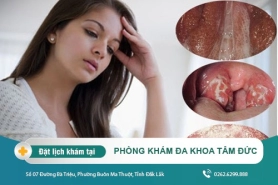 Cách điều trị bệnh lậu tại Đắk Lắk - Dấu hiệu bệnh lậu ở nữ giới là gì?