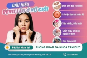 Phương pháp chữa trị bệnh lậu tại Đắk Lắk - Bệnh lậu ở nữ có biểu hiện gì?