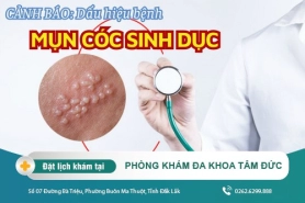 Mụn cóc sinh dục nam và những điều bạn chưa biết