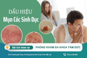 Điều cần biết về mụn cóc sinh dục - Nhận biết sớm để chữa trị kịp thời