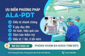 Những cách trị sùi mào gà hiệu quả hiện nay