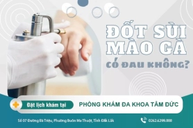 Phương pháp chữa sùi mào gà tại Đắk Lắk - Đốt sùi mà gà có đau không?