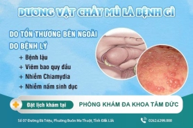 Chớ lơ là khi dương vật bị chảy mủ - bệnh lý dương vật nguy hiểm