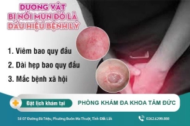 Dấu hiệu bệnh lý chớ xem thường khi dương vật bị nổi mụn đỏ