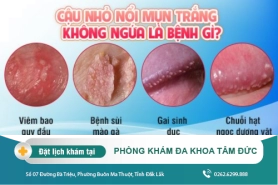 Bệnh liên quan đến dương vật nổi mụn trắng