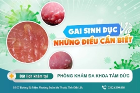 Thông tin chi tiết về gai sinh dục