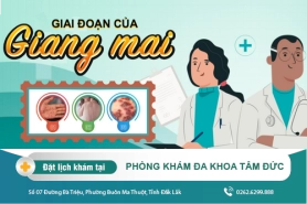 Các giai đoạn phát triển của giang mai và biểu hiện cụ thể