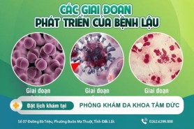 Cách điều trị bệnh lậu tại Đắk Lắk – Nguyên nhân gây nên bệnh lậu là gì?
