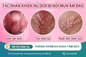 Dấu Hiệu Nổi Mụn Ở Vùng Kín Nữ? Có Mấy Loại Mụn Ở Vùng Kín?