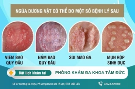 Ngứa dương vật - hiện tượng phổ biến ở phái nam