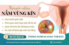 Những nguyên nhân nấm vùng kín cần nắm rõ