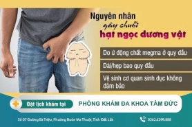 Tổng hợp kiến thức cho nam giới về chuỗi hạt ngọc dương vật