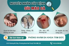 Cách điều trị sùi mào gà tại Đắk Lắk – Nhận biết sùi mào gà qua dấu hiệu gì?
