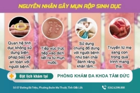 Những thông tin tổng quan về mụn rộp sinh dục