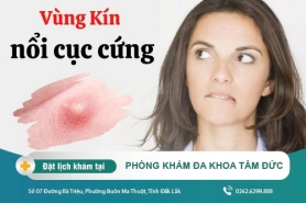 Vùng kín nữ giới bị nổi mụn cứng - Dấu hiệu bệnh lý nguy hiểm