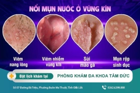Mụn nước ở vùng kín do tác nhân nào gây ra - dấu hiệu bệnh lý gì