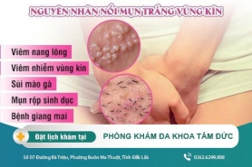 Vùng kín nữ bị nổi mụn trắng - dấu hiệu của bệnh lý gì?