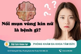Nổi mụn ở lông mu nữ giới - Cách điều trị bệnh nhanh chóng