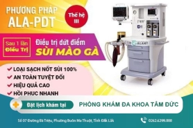 Lỡ mắc sùi mào gà phải làm sao - điều cần biết về sùi mào gà