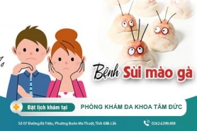 Sùi Mào Gà Là Gì? Những Điều Cần Biết Về Sùi Mào Gà