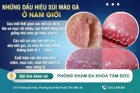 Các dấu hiệu nhận biết bệnh sùi mào gà