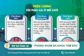 Chữa bệnh sùi mào gà hiệu quả ở nữ