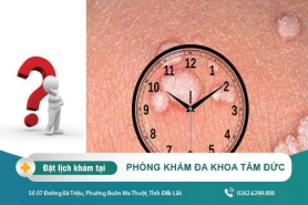 Phương pháp chữa sùi mào gà tại Phòng Khám Đa Khoa Tâm Đức - Thời gian ủ bệnh sùi mào gà là bao lâu?