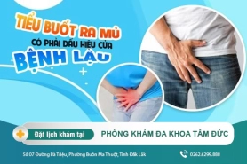 Đi tiểu buốt ra mủ coi chừng bệnh nguy hiểm