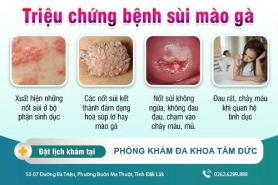 Cách chữa bệnh sùi mào gà tại Phòng Khám Đa Khoa Tâm Đức - Triệu chứng bệnh sùi mào gà là gì?