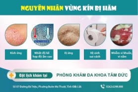 Triệu chứng hăm ở vùng kín và cách điều trị khi gặp phải